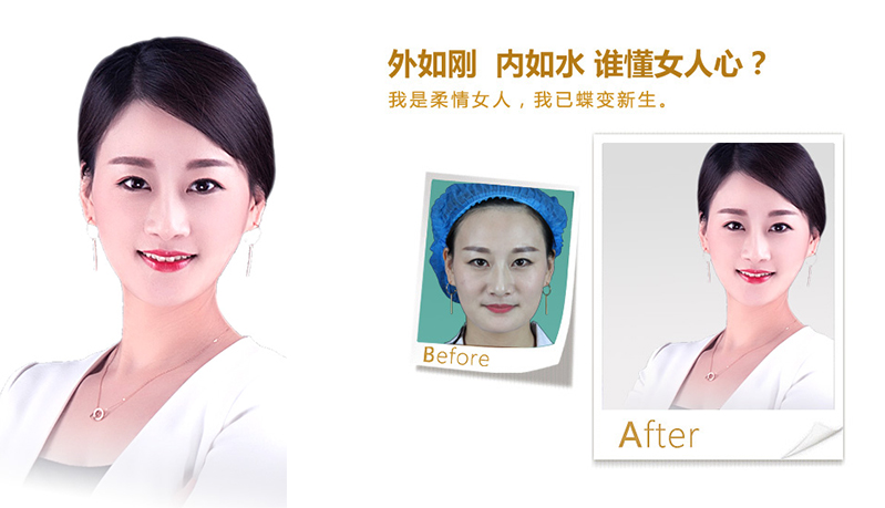 宿迁V脸、线雕隆鼻